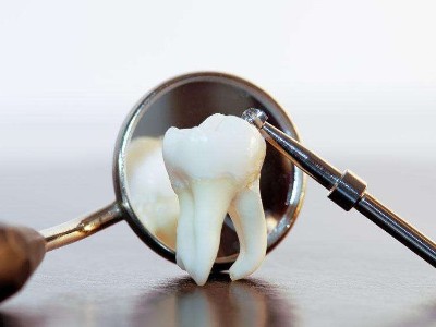 义齿CNC 研磨粉尘净化方案